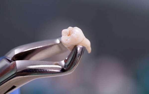 Tooth Extractions in the Virgin Islands