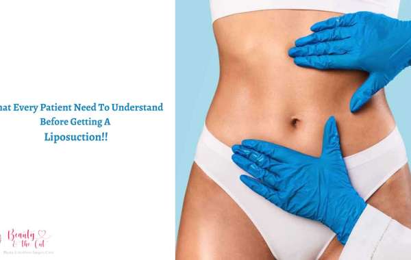 What Every Patient Need To Understand Before Getting A Liposuction