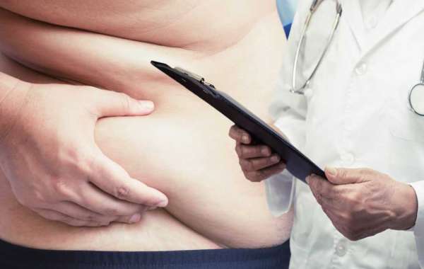 How Can Gastric Sleeve Surgery Help You Shed Pounds?